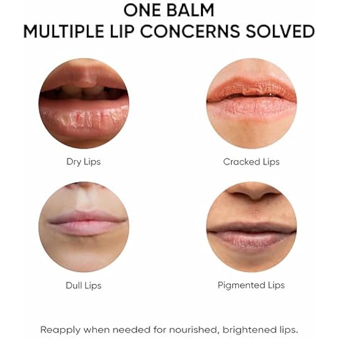 Masofta SHEA BUTTER LIP BALM WITH KOJIC ACID, ALPHA ARBUTIN & SHEA BUTTER FOR SMOOTH, CRACK FREE & CLEAR LIPS, SPF 30 PA++, FOR MEN & WOMEN, 0.52 OZ/15GMS - Image 3